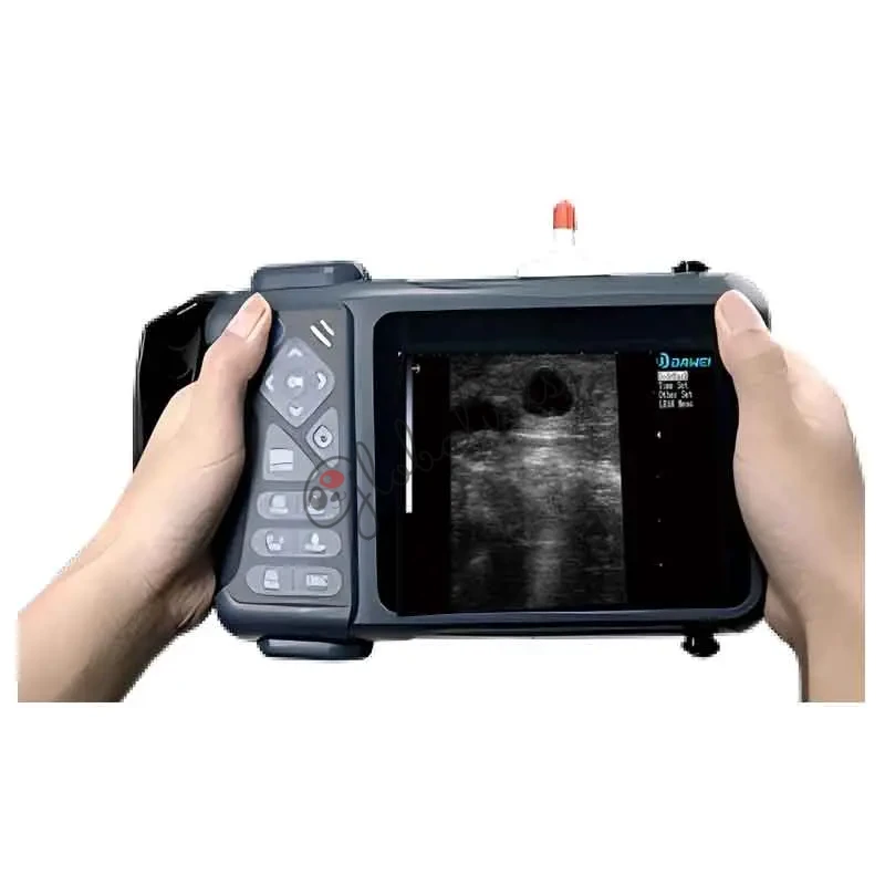 Livestock Ultrasound Machine for Cattle, Sheep &amp; Pigs | Veterinary Pregnancy Scanner