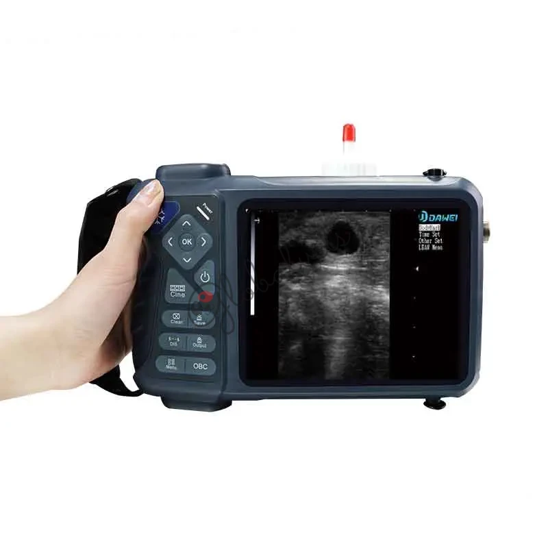 Livestock Ultrasound Machine for Cattle, Sheep & Pigs | Veterinary Pregnancy Scanner