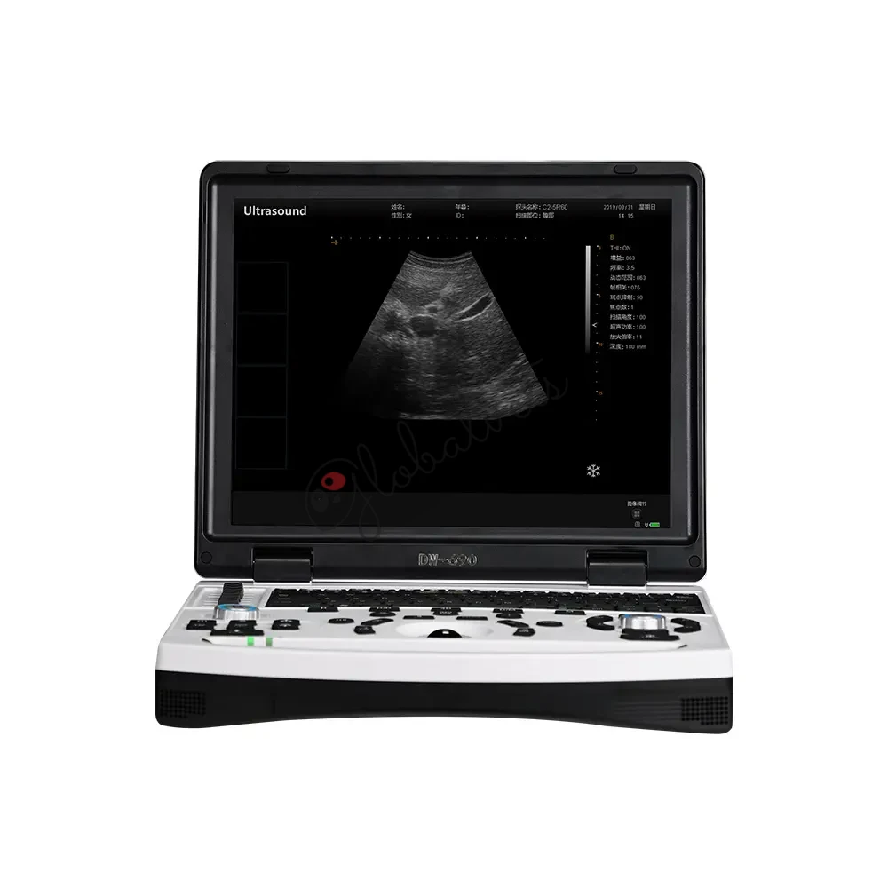 Laptop Veterinary Ultrasound Diagnostic Machine 690 Vet