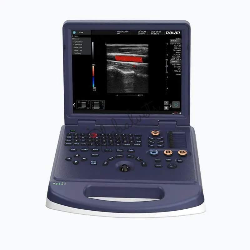 Pet Ultrasound Machine