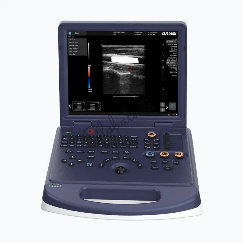 Pet Ultrasound Machine