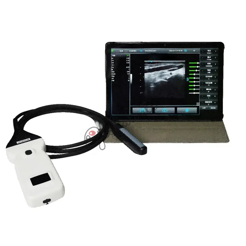 Wireless Rectal Ultrasound Probe for Equine and Bovine Reproduction