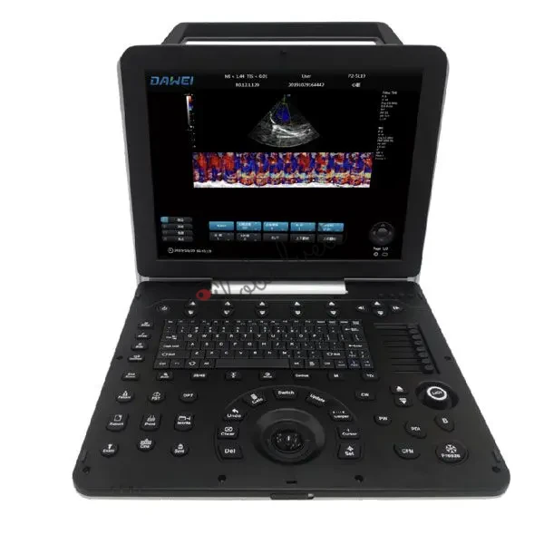 Portable Veterinary Doppler Ultrasound Machine Imaging for Dogs, Cats &amp; Exotic Animals