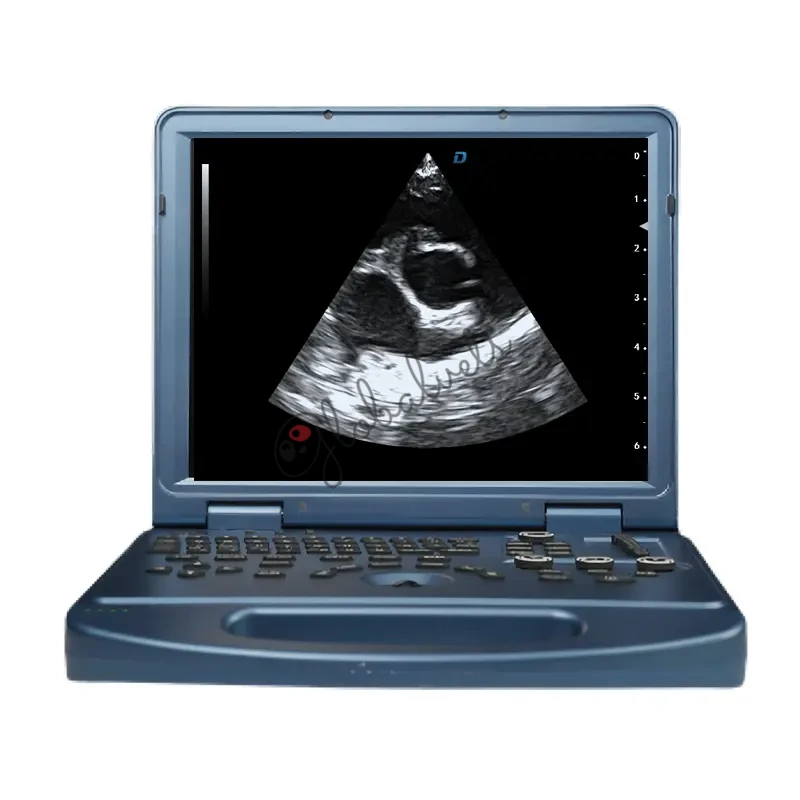 Portable Color Doppler Ultrasound Pet Ultrasound Scanner for Dogs and Cats