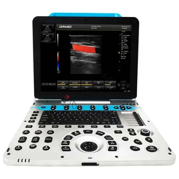Portable color Doppler Veterinary Ultrasound System For Various Animals